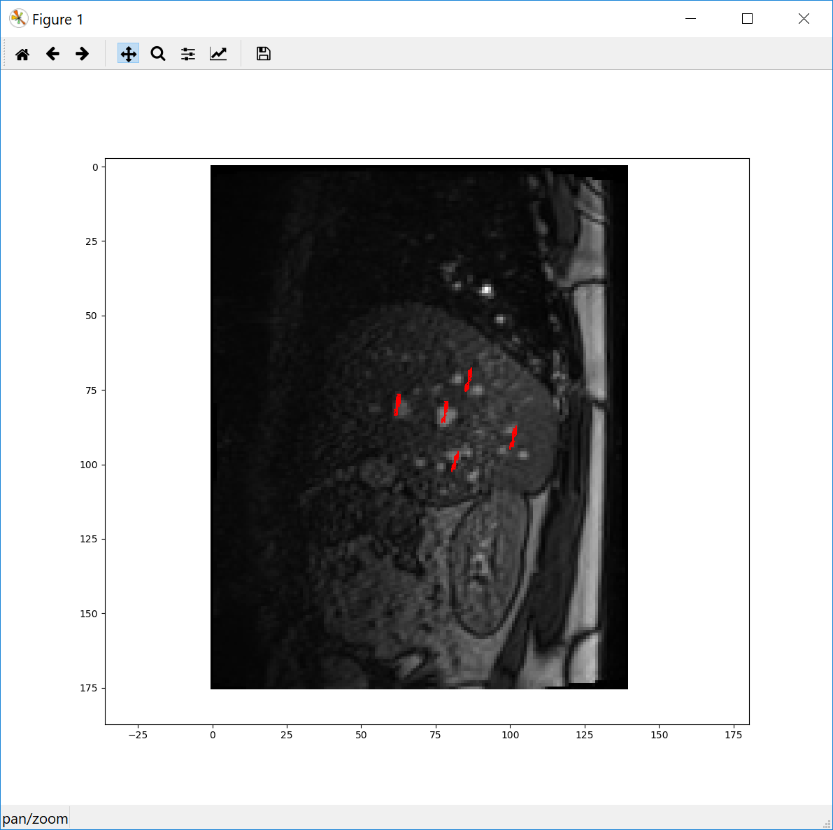 vessle tracking