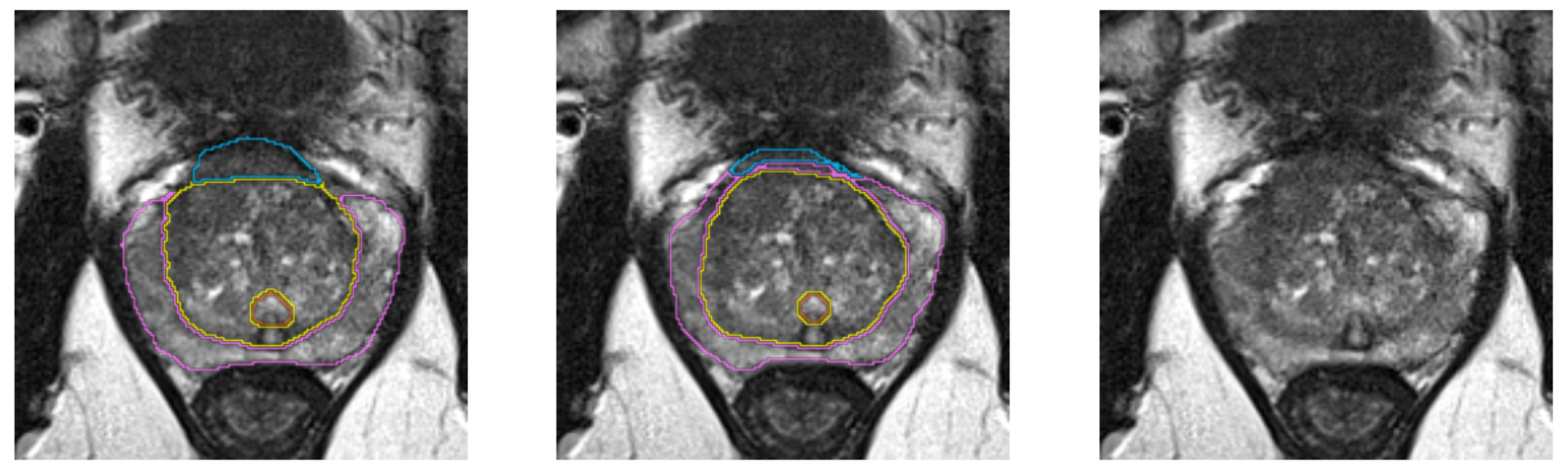 Segmentation Example 3