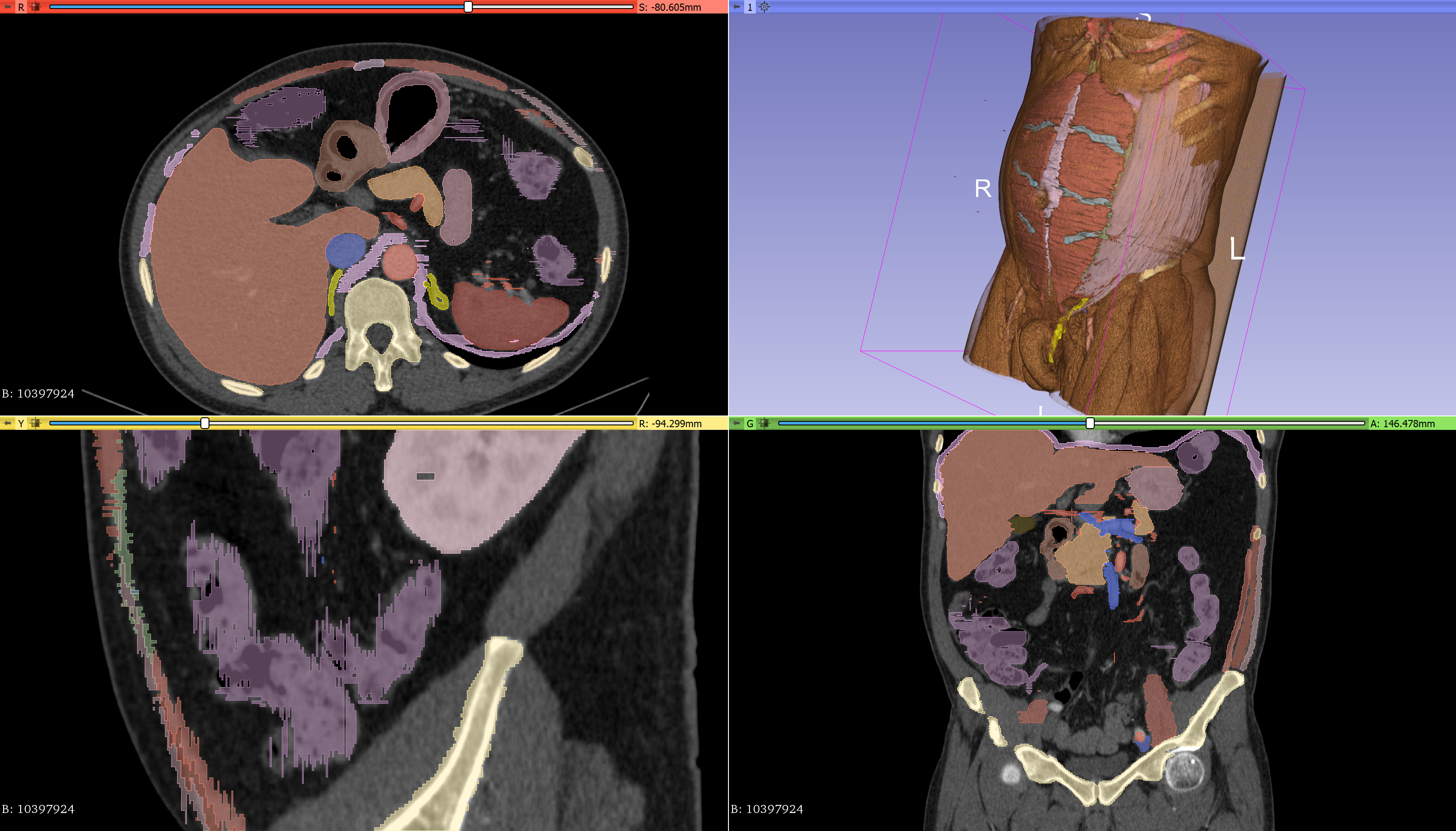 Overview of the segmentation